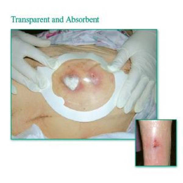 3M Tegaderm Clear Absorbent Acrylic Dressing, Small 3 x 3-3/4 In. Oval, 1-1/2 x 2-1/4 In.Pad