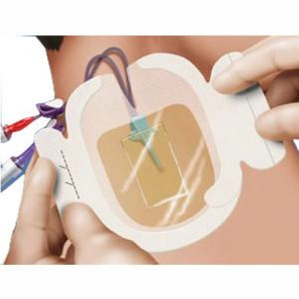 3M Tegaderm CHG IV Securement Dressings